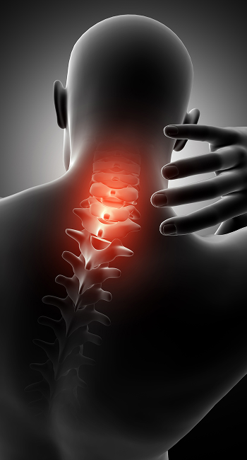 neck pain
